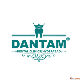Dental Bridges Treatment in Kondapur for Missing Teeth Replacement
