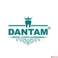 Dental Bridges Treatment in Kondapur for Missing Teeth Repla...