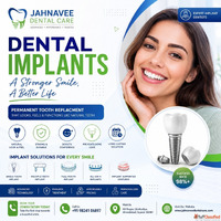 Dental Implants in Ahmedabad - Jahnavee Dental care