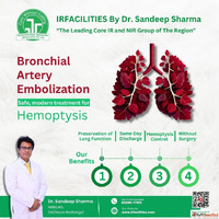 BAE Procedure Advance Bronchial Artery Embolization Treatmen...