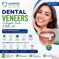 Cosmetic Dental Veneers Treatment - Jahnavee Dental care