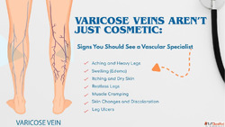 Varicose Veins Treatment in Delhi Without Surgery - Dr Akash...