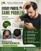 Say Goodbye to Stubborn Skin Hair Concerns with Expert Care