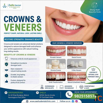 Top-Rated Crowns and Veneers Clinic Ahmedabad