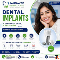 Best Dental Implants in Ahmadabad Jahnavee Dental Care
