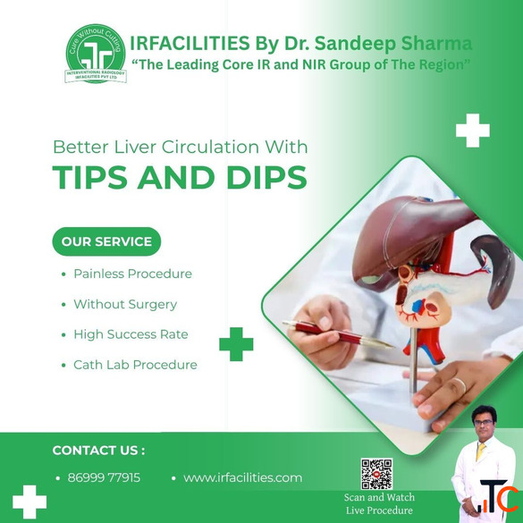 TIPS Procedure - An Expert Minimally Invasive Treatment for the Liver IRFacilities