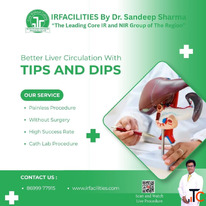 TIPS Procedure - An Expert Minimally Invasive Treatment for the Liver IRFacilities
