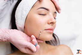 Best Thread Lifting Treatment in Amritsar Cosmetique by Simrat Sandhu