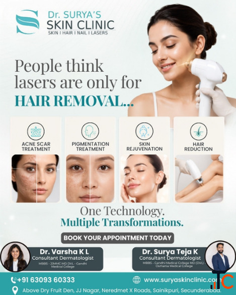 Best Laser Treatment in Secunderabad Dr. Surya's Skin Clinic