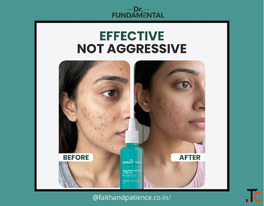 Moisturizer for Oily Acne Prone Skin - Non-Comedogenic Formula