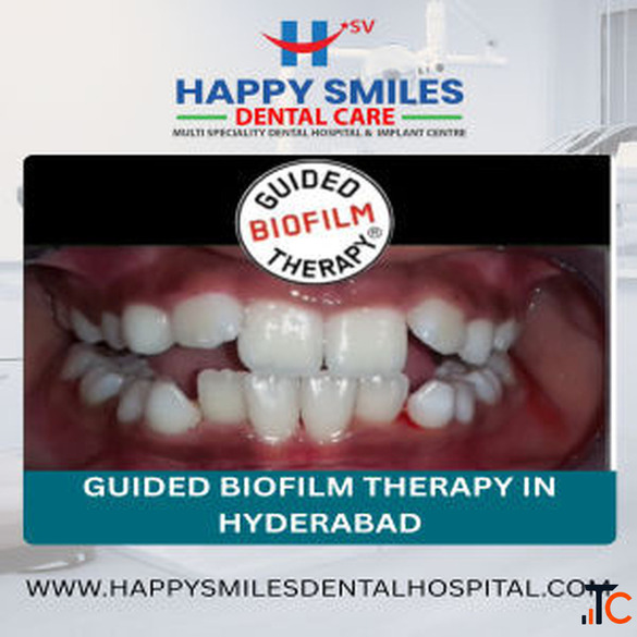 Affordable Guided Biofilm Therapy Cost in Hyderabad Advanced Dental Cleaning Solutions