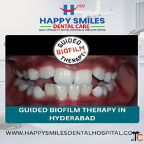 Affordable Guided Biofilm Therapy Cost in Hyderabad Advanced Dental Cleaning Solutions