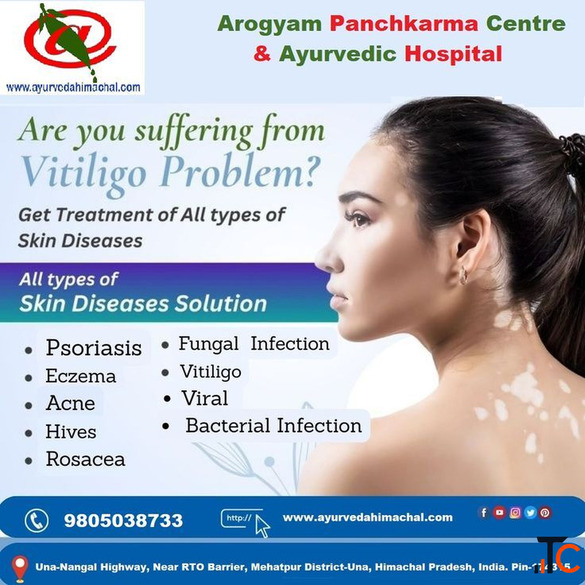 AROGYAM PURE HERBS KIT FOR VITILIGO