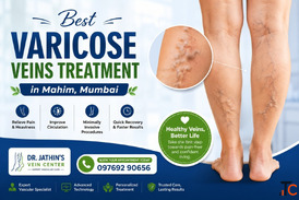 Expert Vein Care with Modern Technology