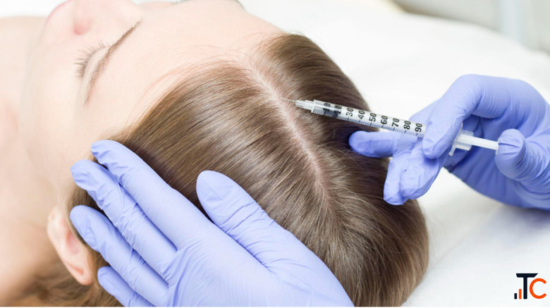 Hair Transplant Thrissur Your Complete Guide to Natural Hair Restoration