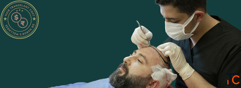 Real Results Real Value at Affordable Hair Transplant Cost
