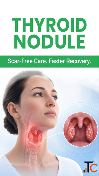 Thyroid Nodule Treatment Without Surgery in India Advanced Treatment IRFacilities