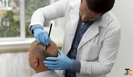 Affordable Hair Restoration Without Compromising Quality