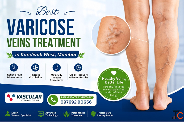 Innovative Vein Treatment for Better Leg Health