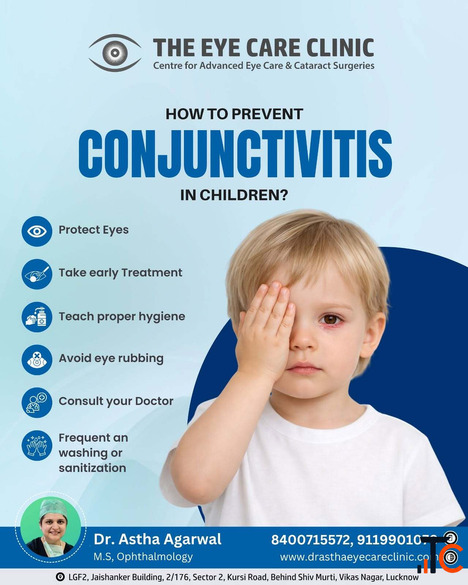 Conjunctivitis Alert Protect Your Eyes This Monsoon