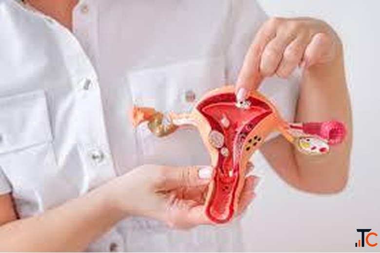 UFE Cost in Chandigarh Expert Fibroid Care IRFacilities