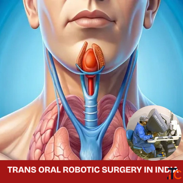Trans Oral Robotic Surgery in India