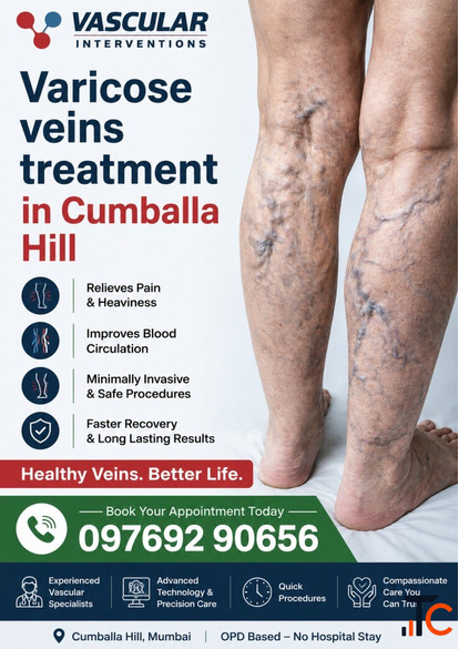Advanced Vein Care for Everyday Comfort