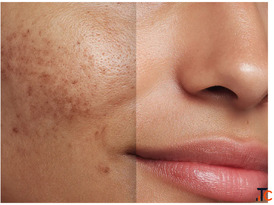 Pigmentation Treatment What Dermatologists Actually Recommend