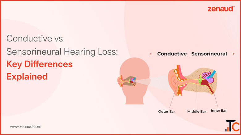 Conductive vs Sensorineural Hearing Loss Zenaud