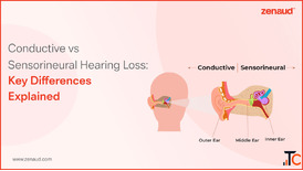 Conductive vs Sensorineural Hearing Loss Zenaud