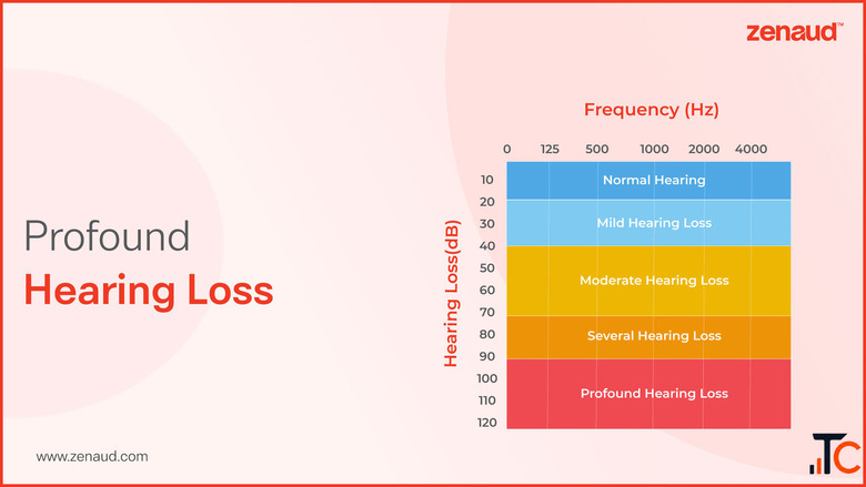 Profound Hearing Loss - Zenaud