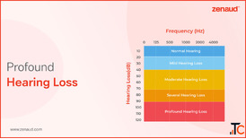 Profound Hearing Loss - Zenaud