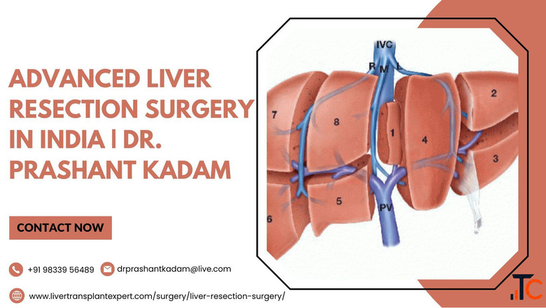 Advanced Liver Resection Surgery in India Dr. Prashant Kadam