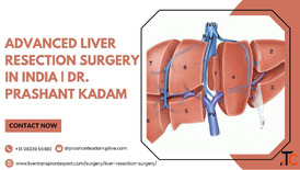 Advanced Liver Resection Surgery in India Dr. Prashant Kadam