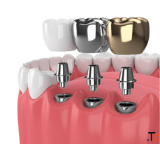 Dental Clinic in Madurai