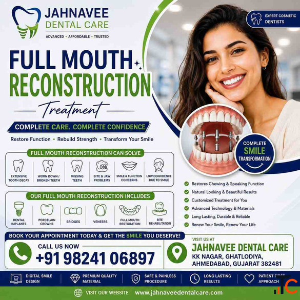 Full Mouth Reconstruction Treatment in Ahmadabad DR. Jahanvee