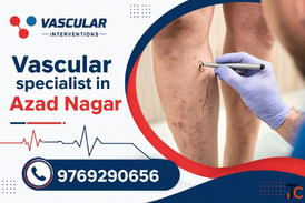 Compassionate Care for Healthier Veins