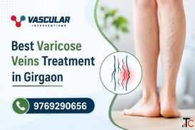 Comprehensive Vein Care with Compassion