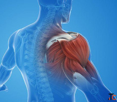 Shoulder Impingement in Gurgaon Expert Physiotherapy for Lasting Shoulder Pain Relief