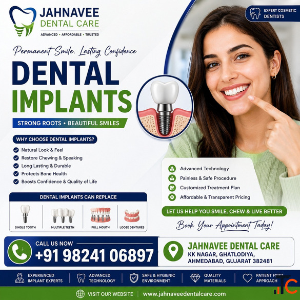 Get Dental Implants in Ahmadabad by Expert Dentists - Jahnavee