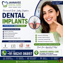 Get Dental Implants in Ahmadabad by Expert Dentists - Jahnavee