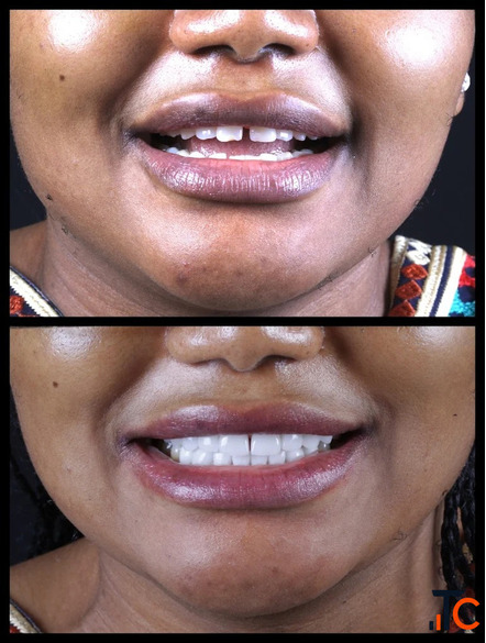 India's Leading Award-Winning Dentists Rarity Dental