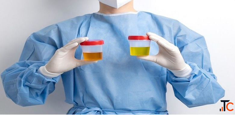 Book a Urine Test Online from Max Lab