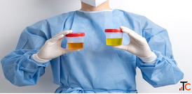 Book a Urine Test Online from Max Lab