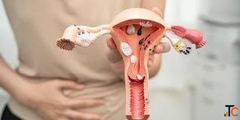 Uterine Fibroid Embolization Cost in India Affordable UFE Treatment