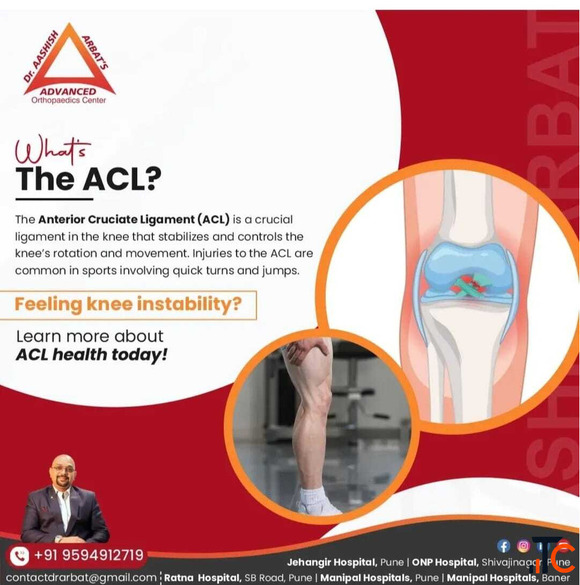 ACL reconstruction surgery Pune Maharashtra India - Dr. Aashish Arbat