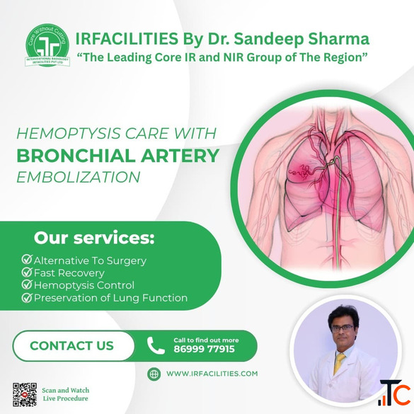 Bronchial Artery Embolization State-of-the-Art Treatment for Hemoptysis