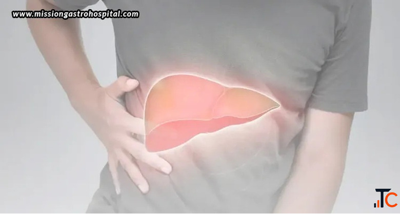 Best Liver Specialist Doctor in Ahmedabad Book an Appointment at Mission Gastro Hospital Today