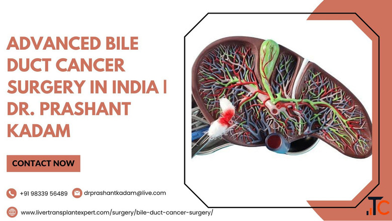 Advanced Bile Duct Cancer Surgery in India Dr. Prashant Kadam