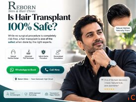 Can Hair Transplant Near Balewadi Help Restore Your Lost Hair Naturally